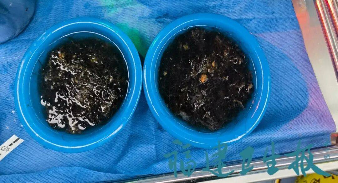 皇冠信用網在线注册_发现一例皇冠信用網在线注册,10岁女孩确诊!已有多起病例,有人因羞耻感延误就医