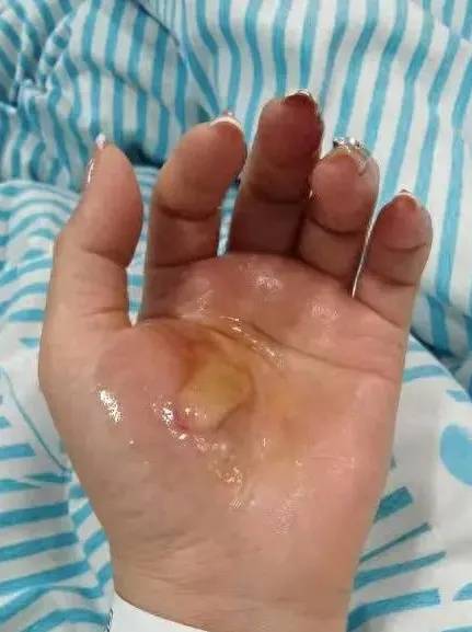 皇冠官网_滚烫的水皇冠官网，从头流到脚！今晚洗澡前紧急提醒！