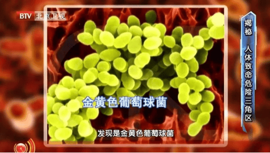 皇冠信用网申请_尽快扔掉!“甲醛超标”冲上热搜皇冠信用网申请,很多深圳人爱囤家里,比你想象得脏多了!网友炸锅